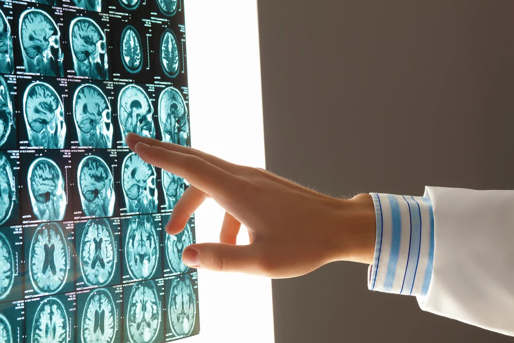 CT Scans: When Do You Need Contrast?